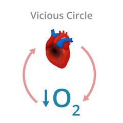 Vicious circle simplified vector diagram.