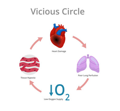 Vicious circle diagram. Conceptual illustration of the heart damage pathophysiology