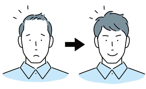 男性の頭部　薄毛に悩む　髪の毛が豊か