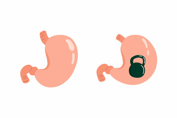 Stomach. Healthy and ailing stomach. Cartoon internal organs. Gastritis and inflammation. Improper diet, acid, infection. Vector illustration isolated on white background.