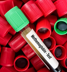 Blood sample for Methemoglobin test with colorful test tube top background, useless form of...