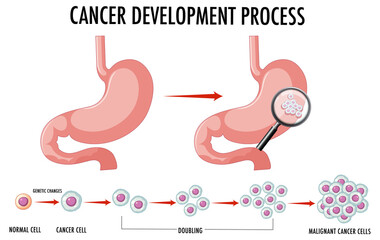 Obraz premium Diagram showing normal and cancer cells in human