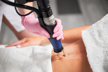 Close up cosmetologist hand in sterile gloves using erbium ablative laser machine while performing lifting procedure on female abdomen. Young woman receiving laser treatment in cosmetology clinic.