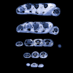 X-ray MRI image of fingers and hand, cross section at various stages of imaging.