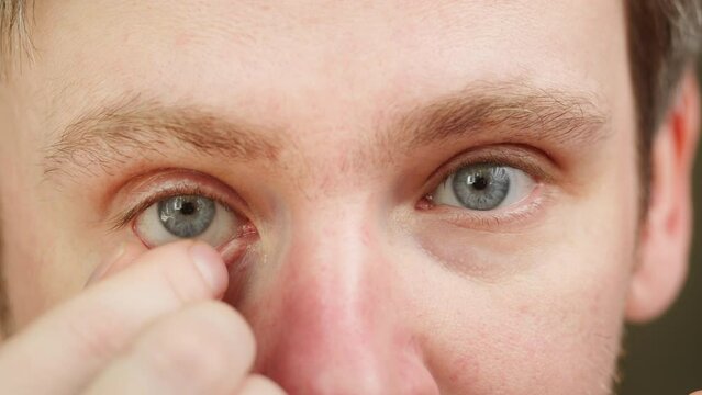 Close-up of a blue-eyed young man taking off contact lens with fingers and blinking. Advertising of contact lenses for vision improvement. Optical shop, health care and medicine concept.