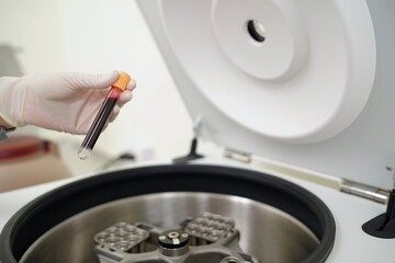 Scientist checking blood tube in Centrifuge Machine, Whole blood is often separated after spin, HIV testing.