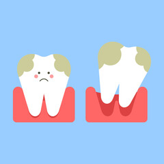 Severely damaged tooth. Removal, dropped out. Illustrations for dentistry. Vector illustration.