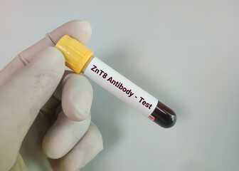 Zinc transporter 8 (ZnT8) antibody test to distinguishes type 1 and type 2 diabetes mellitus