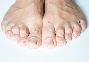 image of hair on human toes