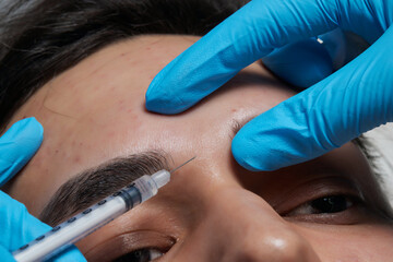 Men's cosmetology. Beautician injects a botulinum toxin into a man's forehead to relax the muscles....