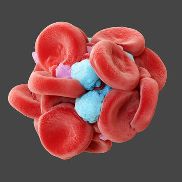 Blood clot, illustration