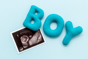 Ultrasound picture of unborn baby - pregnancy concept