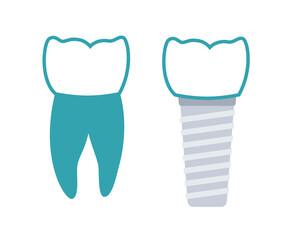 Dental implant procedure
