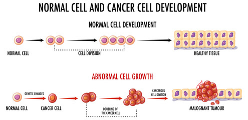 Diagram showing normal and cancer cell