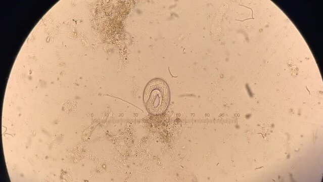Nematode parasitic worm in microscope. larva inside ova movement