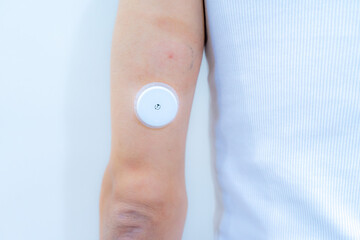 二の腕に装着した測定センサー