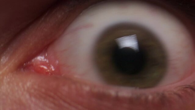 Human eyes with red veins. Potential problems with visceral health by insomnia and stress work can cause paranoia and medical problems