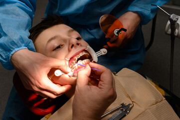 Alignment of crooked teeth with the help of braces, installation of braces for a child, an...