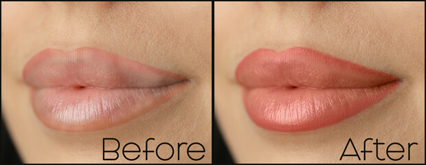 Collage with photos of young woman before and after permanent lip makeup, closeup. Banner design - obrazy, fototapety, plakaty