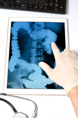 X-ray image of the intestine in the tablet. The concept of telemedicine and diagnosis of diseases