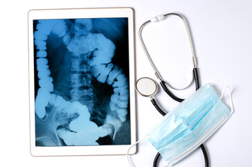 X-ray image of the gastrointestinal tract in a tablet. The concept of telemedicine and diagnosis of...