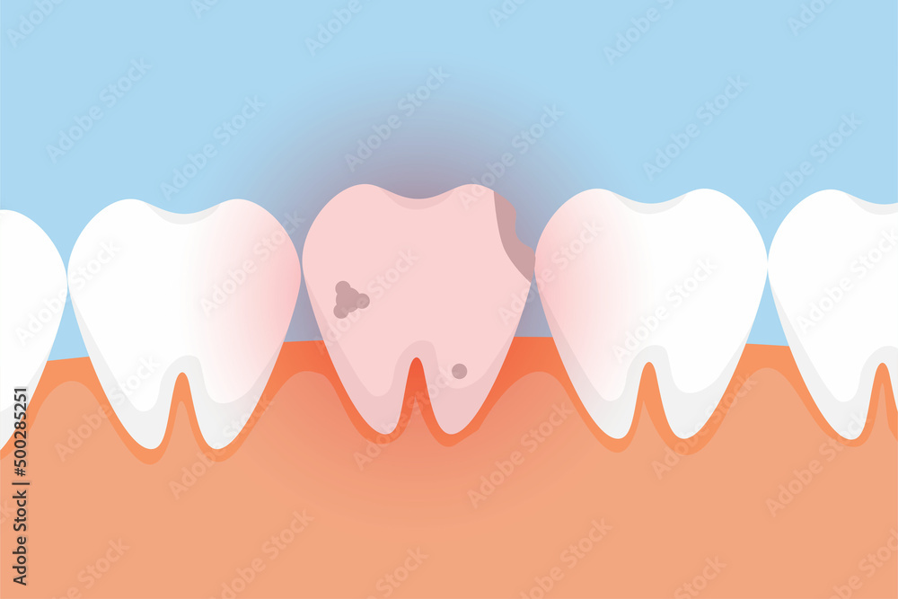 Poster bad tooth hurting with red danger glow effect vector. a dead tooth vector with a red glow effect. a 