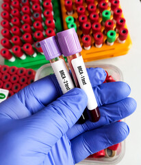 Blood sample for BRCA Genetic test, known as mutations, in genes called BRCA1 and BRCA2.