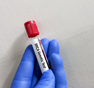 Blood sample for BRCA Genetic test, known as mutations, in genes called BRCA1 and BRCA2.