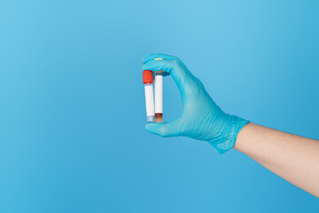 Hand holding two test tubes with stickers for text.