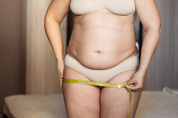 Cropped photo of fat plump overweight woman standing in beige bra, underpants, showing excessive naked belly, measuring hips with tape. Body positive, cellulite, obesity, weight control, liposuction.