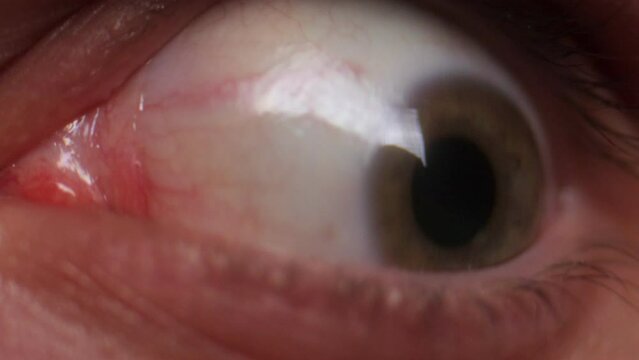 Human eyes with red veins. Potential problems with visceral health by insomnia and stress work can cause paranoia and medical problems