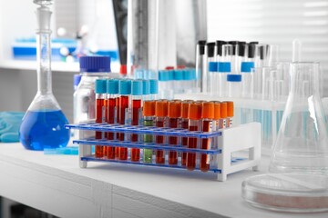Analysis lab sample of new strain of Coronavirus Omicron.