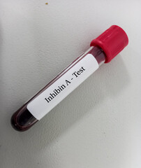 Blood sample for Inhibin A test, diagnosis of Granulosa cell tumours and Mucinous Epithelial Ovarian Tumour, white background