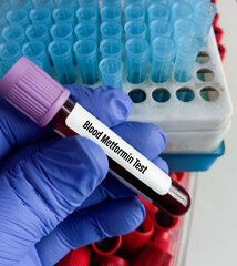 Scientist holding blood sample for Metformin drug test to set therapeutic range for diabetic...