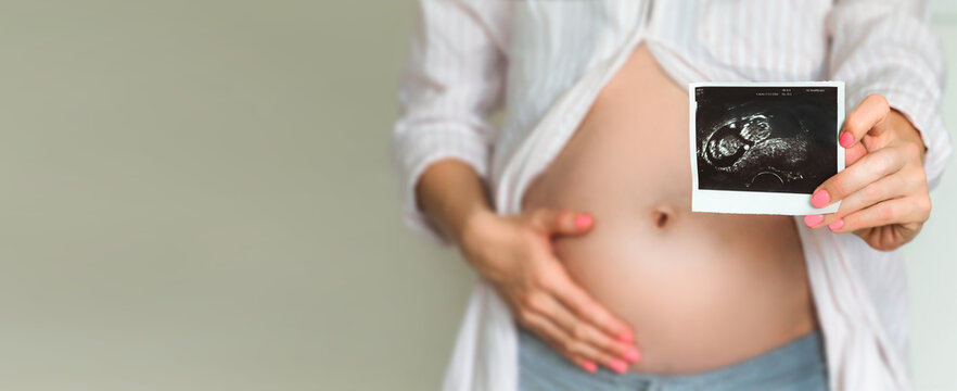 Pregnant girl holding ultrasound picture in the hands in front of view, cropped closeup image. Baby concept.
