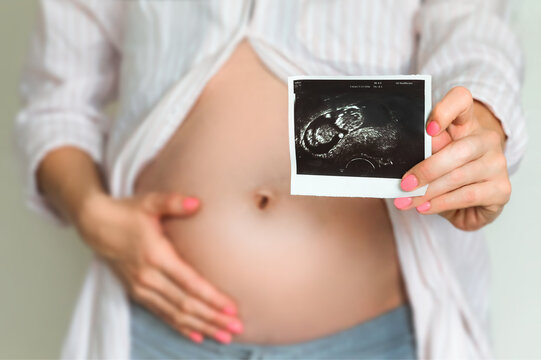 Pregnant girl holding ultrasound picture in the hands in front of view, cropped closeup image. Baby concept.