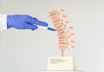 The doctor shows a model of the human spine, which shows various defects in the vertebrae....