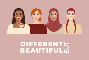 Female faces with vitiligo skin disease banner. Different but beautiful concept. Portraits with different ethnics, skin colors, hairstyles with vitiligo. Body positive, flat vector illustration
