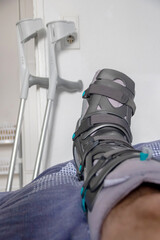 European man after Achilles tendon rupture operation is back home with special physiotherapy shoe...