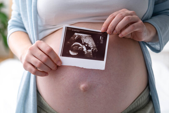 Top view cropped of pregnant woman with ultrasound photo of fetus standing at home, young future mom waiting child first baby, pregnancy and motherhood concept