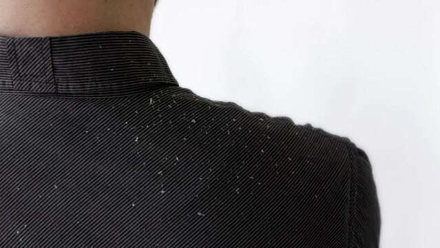 Man in a black shirt swipes dandruff of his shoulder. Close-up. The concept of psoriasis and seborrheic dermatitis.