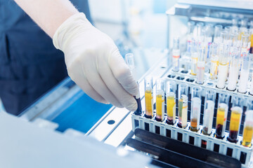 Scientist nurse downloads blood test samples to dna, hiv, aids, Coronavirus on automatic...