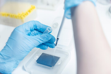 Macro photo hand of medical worker, Biochemical analyzer blood tests on modern equipment of...