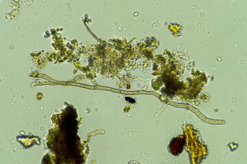 biological organisms under the microscopes in australia. living microorganisms