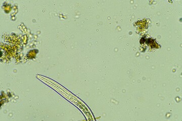 biological organisms under the microscopes in australia. living microorganisms