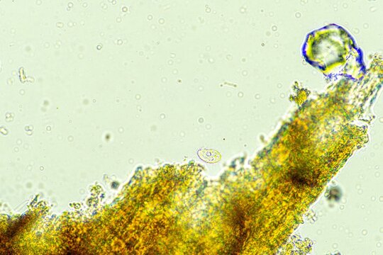 biological organisms under the microscopes in australia. living microorganisms