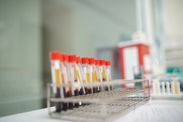 Sample blood tube in rack  for analytical testing including  HIV in laboratory, Soft focus.