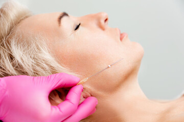 Thread lifting procedure. Professional beautician in medical gloves holding needle. Close up face...