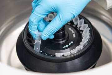 Scientist puts microcentrifuge tubes into centrifuge for phase separation. Metabolomic and...