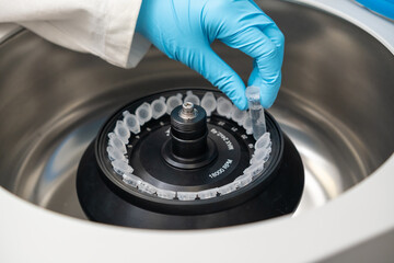 Scientist puts microcentrifuge tubes into centrifuge for phase separation. DNA and cell analysis at...